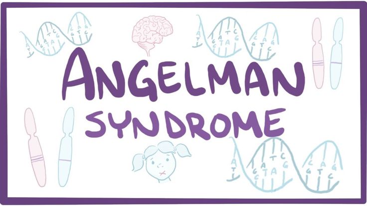 Unraveling the Mystery of Angelman Syndrome: A Closer Look at the Rare Genetic Disorder